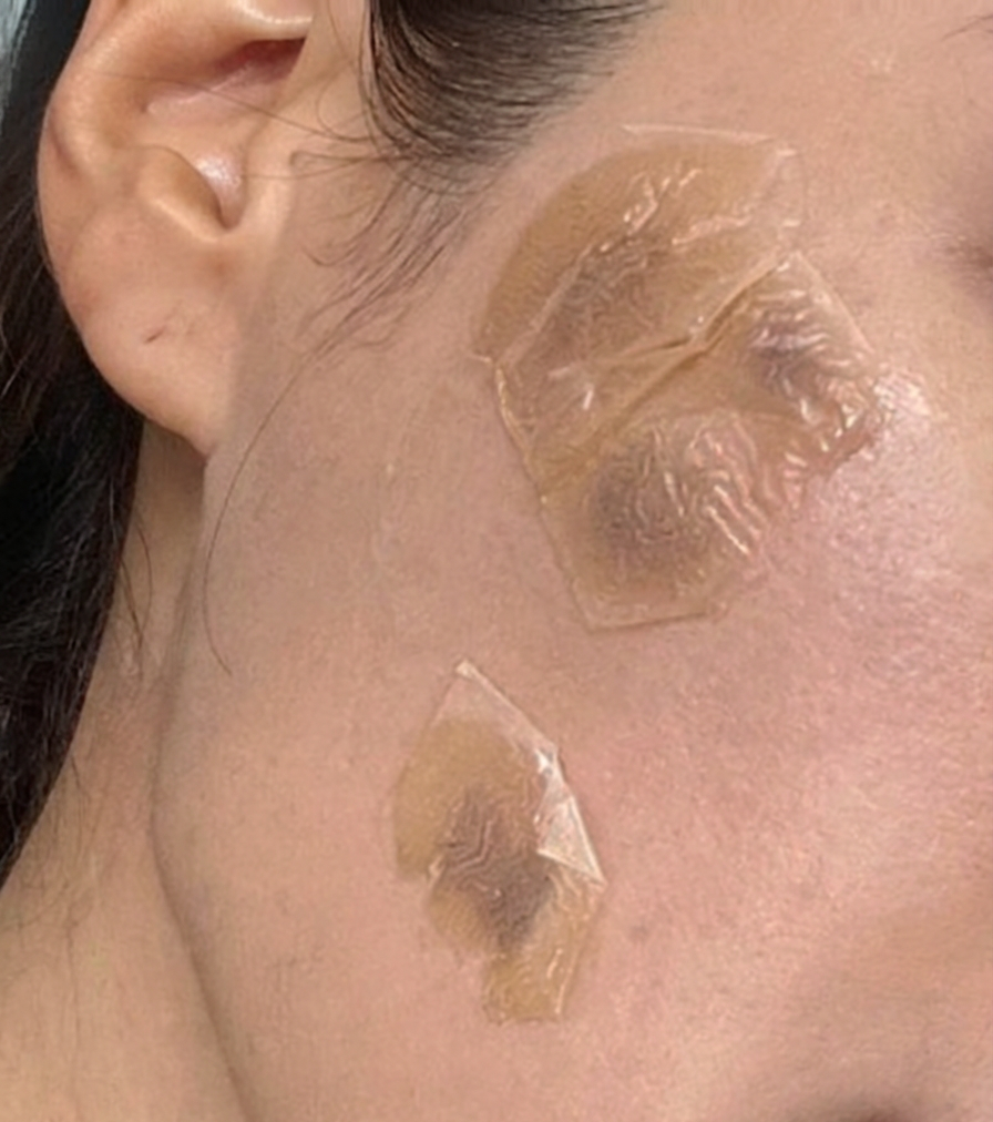 수술후기이미지