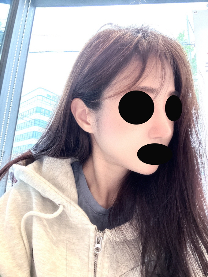 수술후기이미지