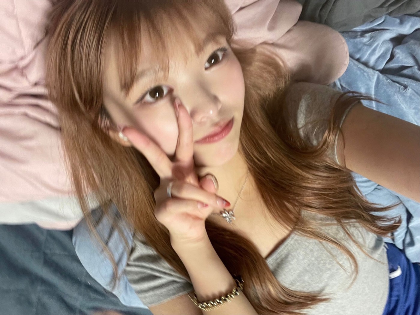 수술후기이미지