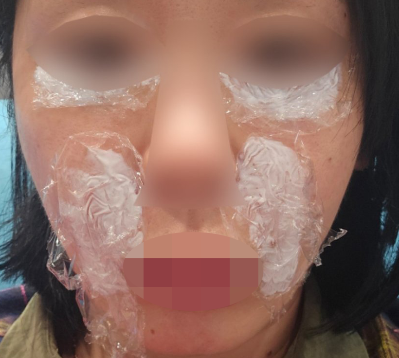 수술후기이미지