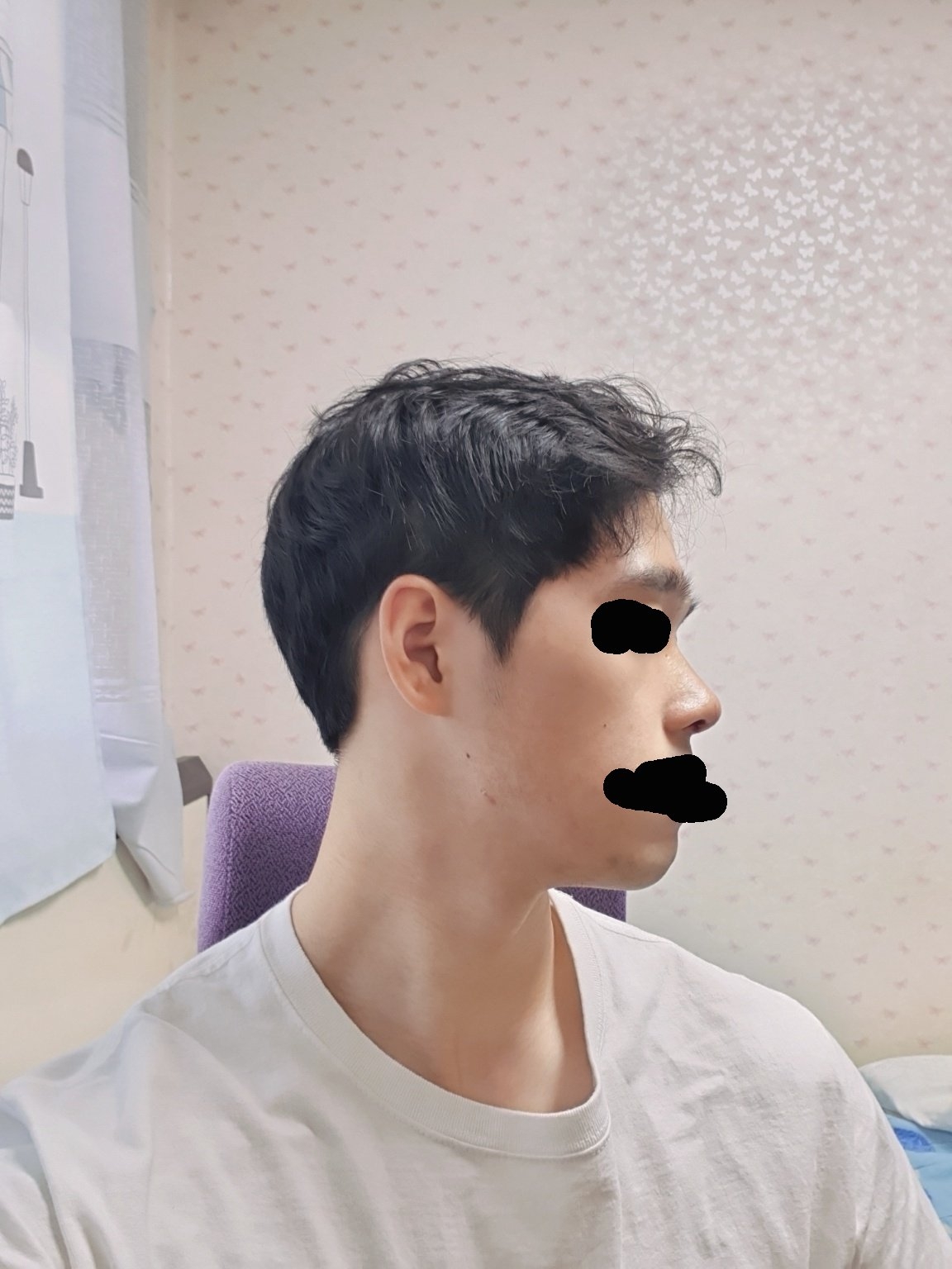 수술후기이미지