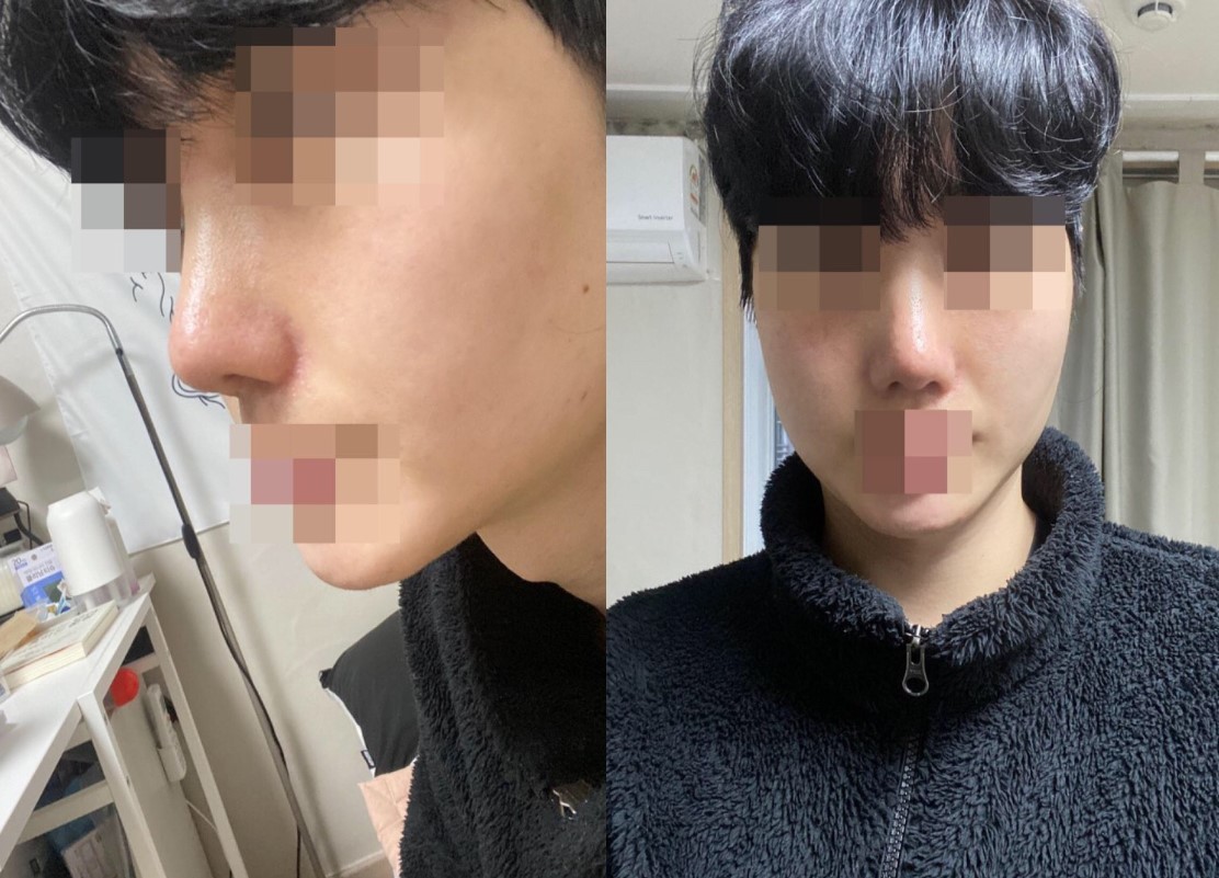 수술후기이미지