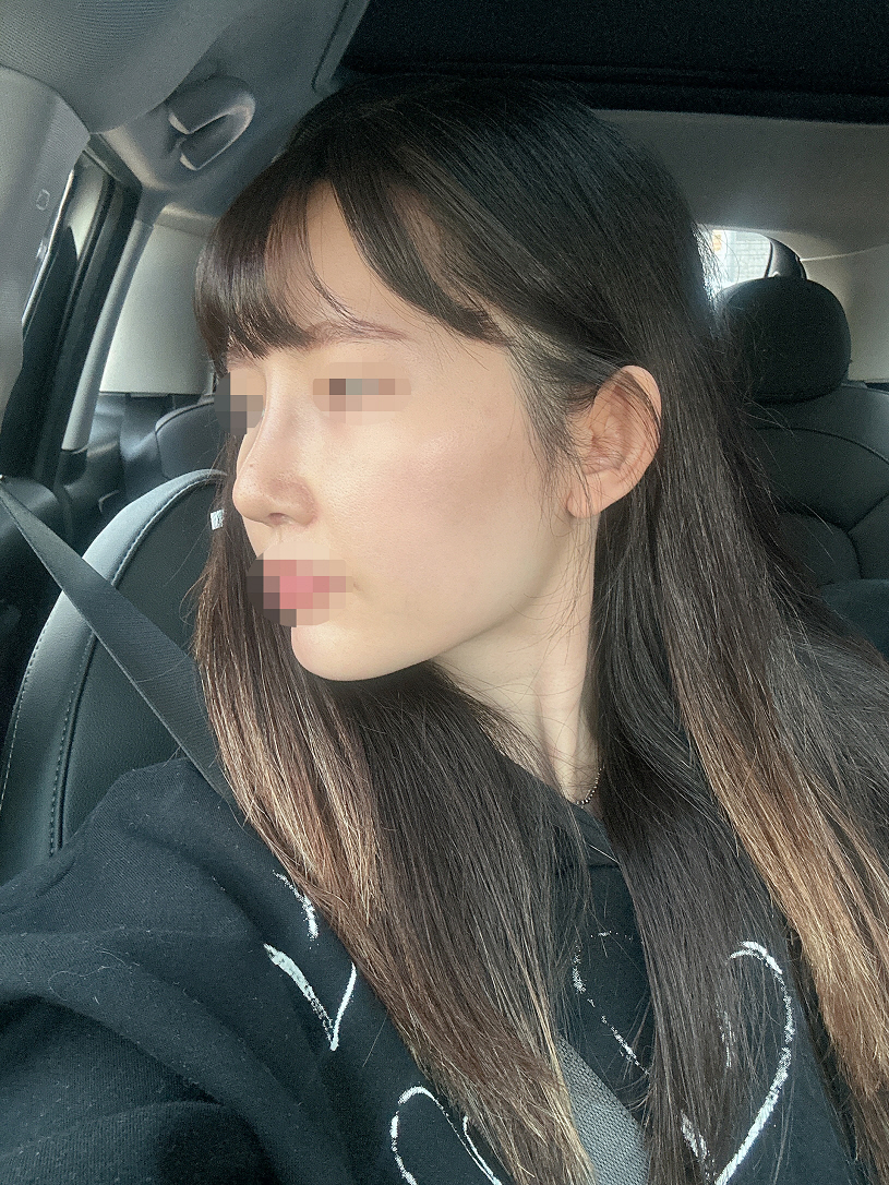 수술후기이미지