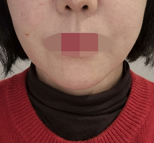 수술후기이미지