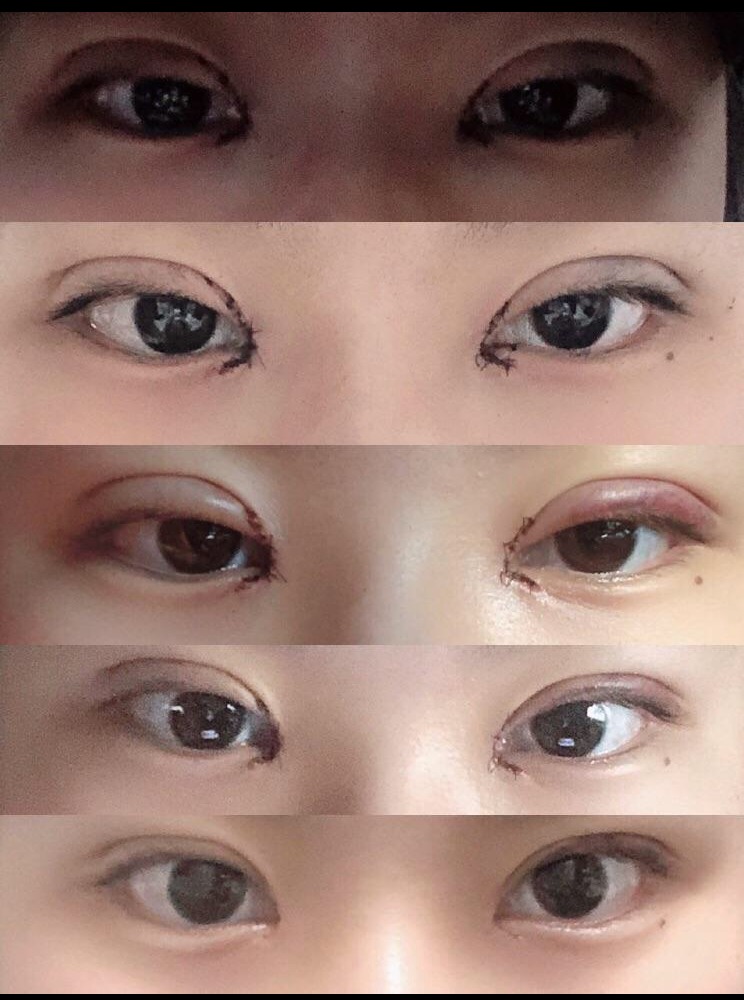 수술후기이미지