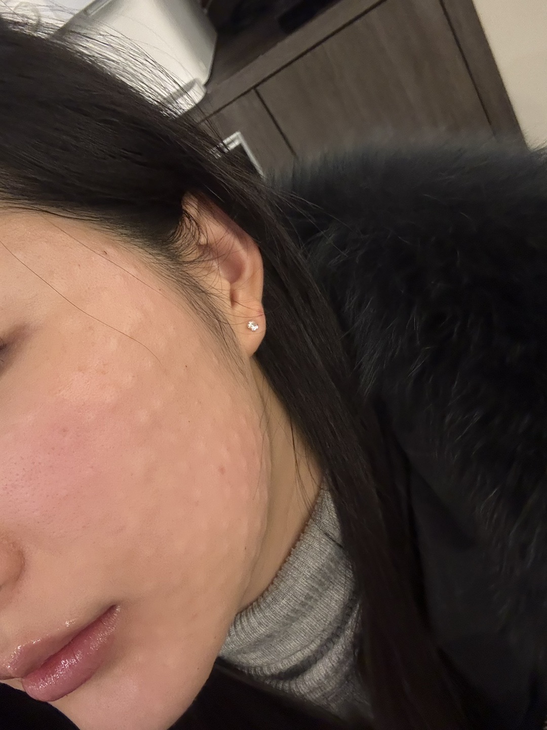 수술후기이미지