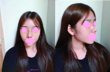 수술후기이미지