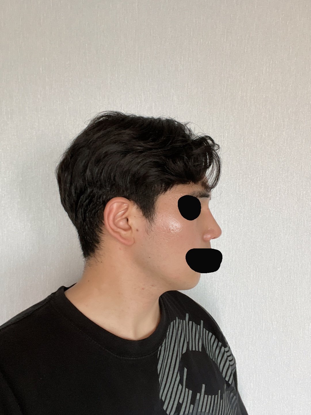 수술후기이미지