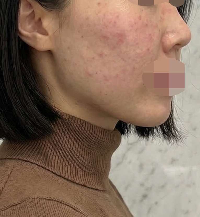 수술후기이미지