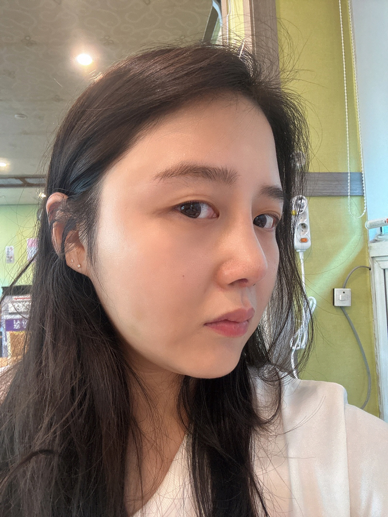 수술후기이미지