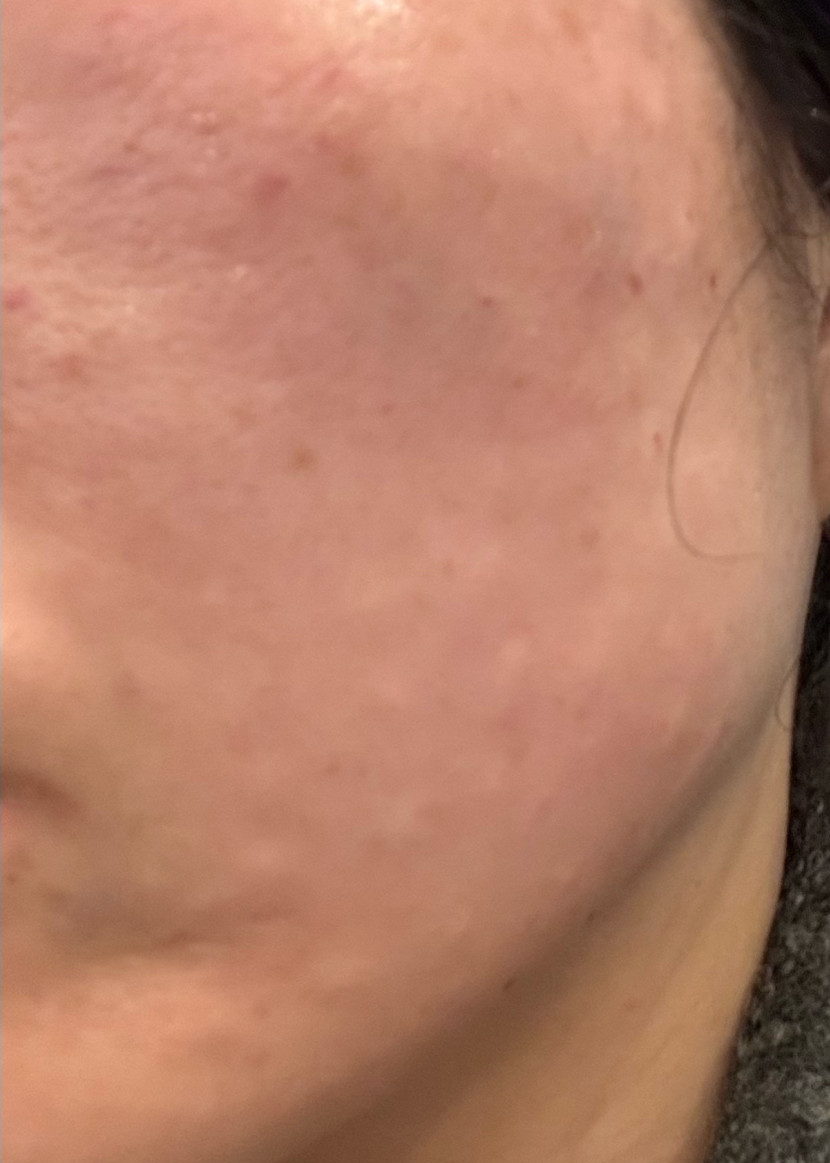 수술후기이미지